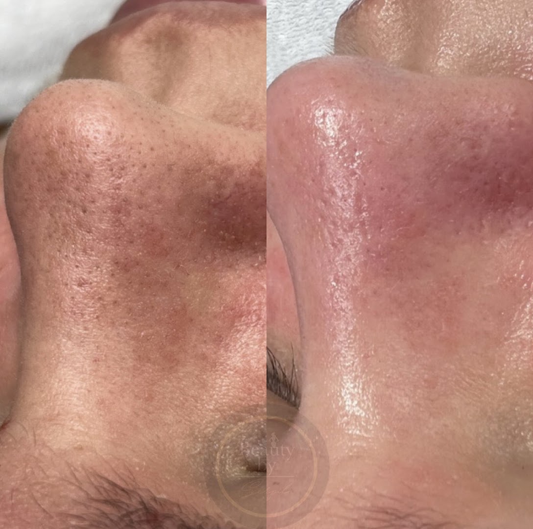 Foto van BEAUTY BY SERPIL : Laserontharing, huidverbetering, lash lift, browlift, hennabrows in Zele — Schoonheidsspecialist (foto 2)