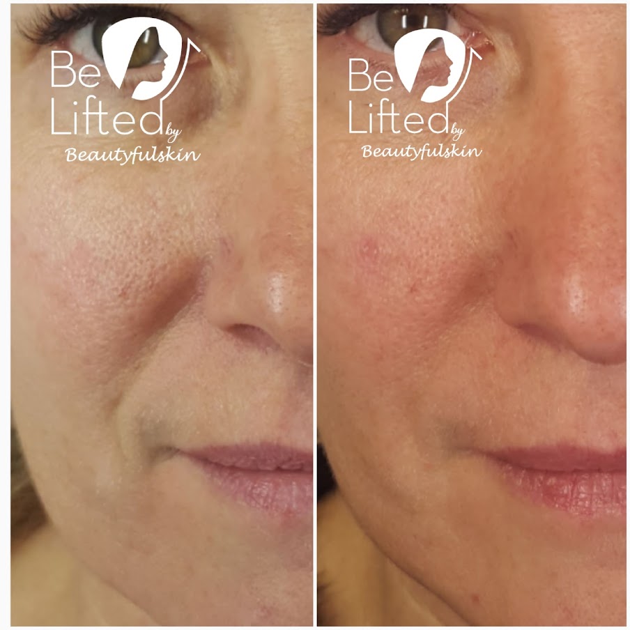 Foto van Beautyfulskin in Oostende — Huidverzorgingskliniek (foto 3)