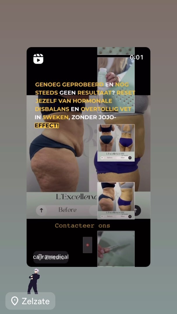 Foto van Calira Medical in Zelzate — Schoonheidssalon (foto 2)