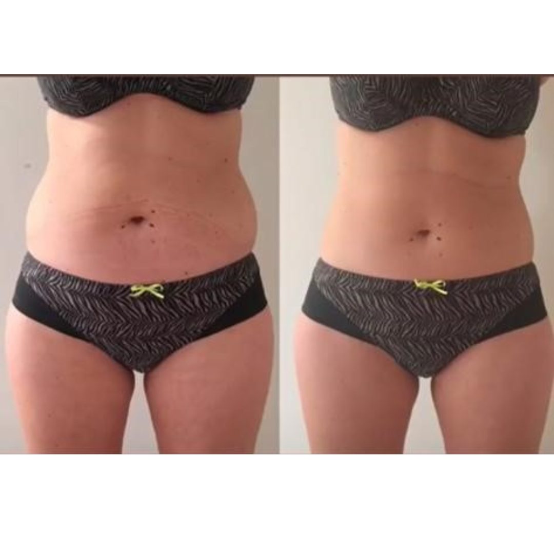 Foto van Cryo Shaping in Knokke-Heist — Schoonheidssalon (foto 2)