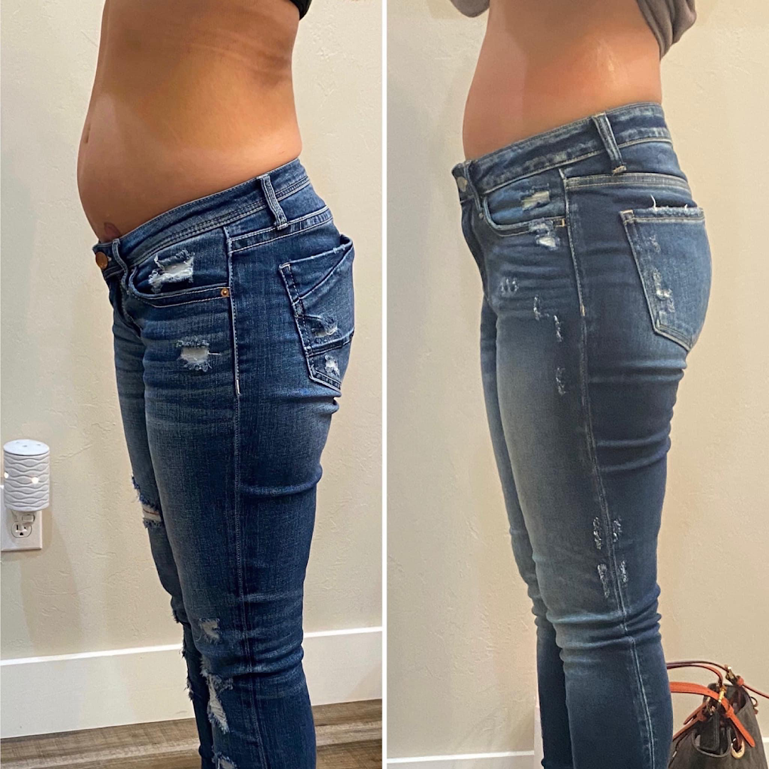 Foto van Cryobeauty in Tessenderlo-Ham — Schoonheidssalon (foto 3)