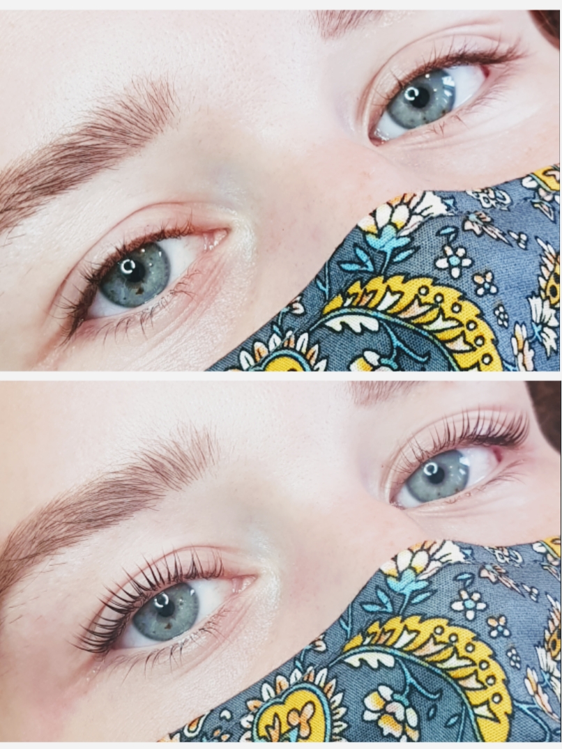 Foto van Dermacare Laserclinic & Spa in Turnhout — Schoonheidssalon (foto 2)