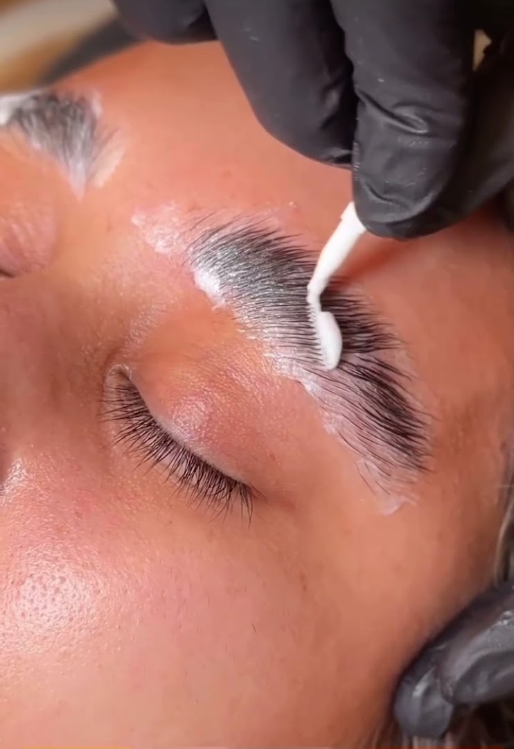 Foto van Dermalux Clinic in Malle — Schoonheidssalon (foto 3)