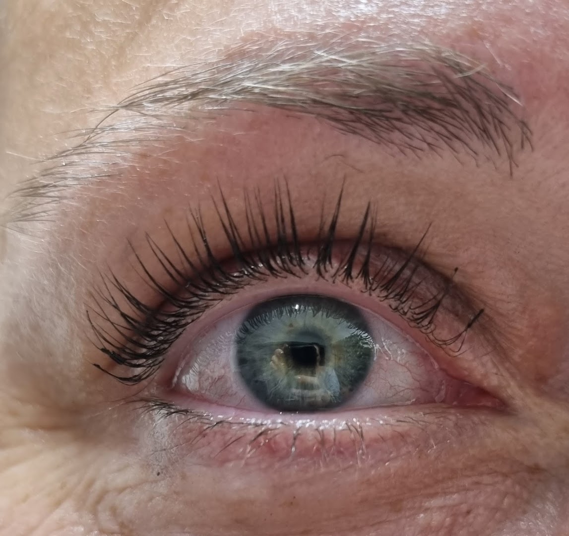 Foto van GINA Studio - LaserOntharing, Plasma Pen, Roeselare Schoonheidssalon in Roeselare — Ontharing met laser (foto 2)