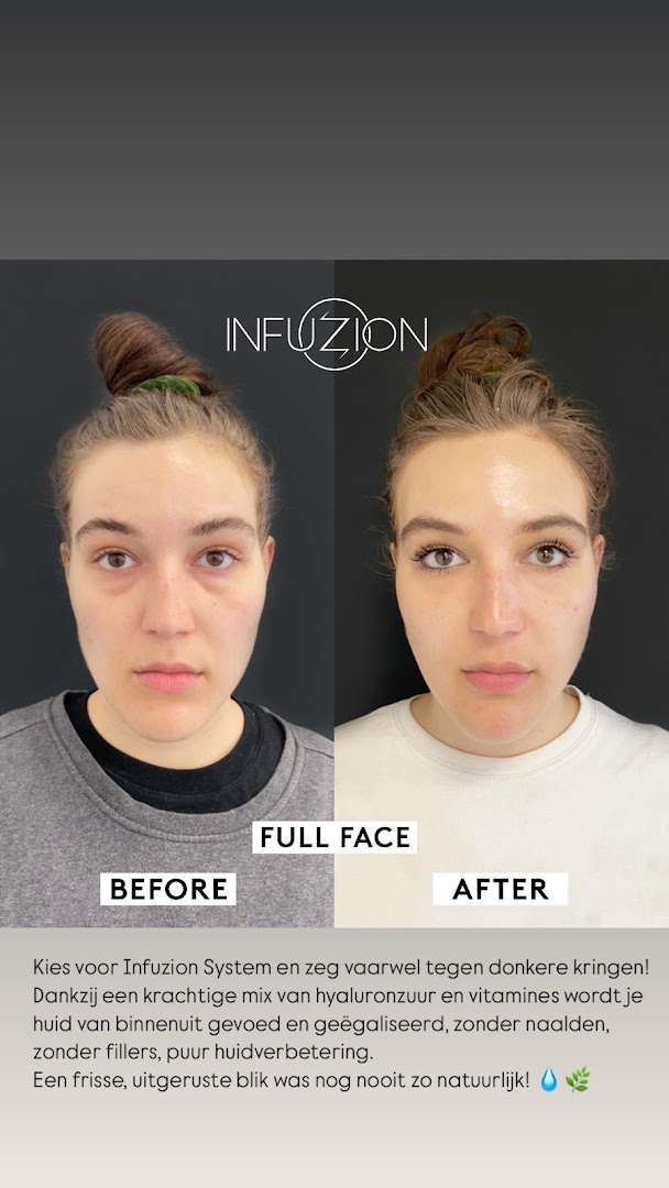 Foto van GLAZE CLINIC BEAUTYSALON • Laserontharing | Littekens | Anti-Aging | Tanden Bleken | Head Spa | Lashes & Brows in Wetteren — Schoonheidssalon (foto 1)