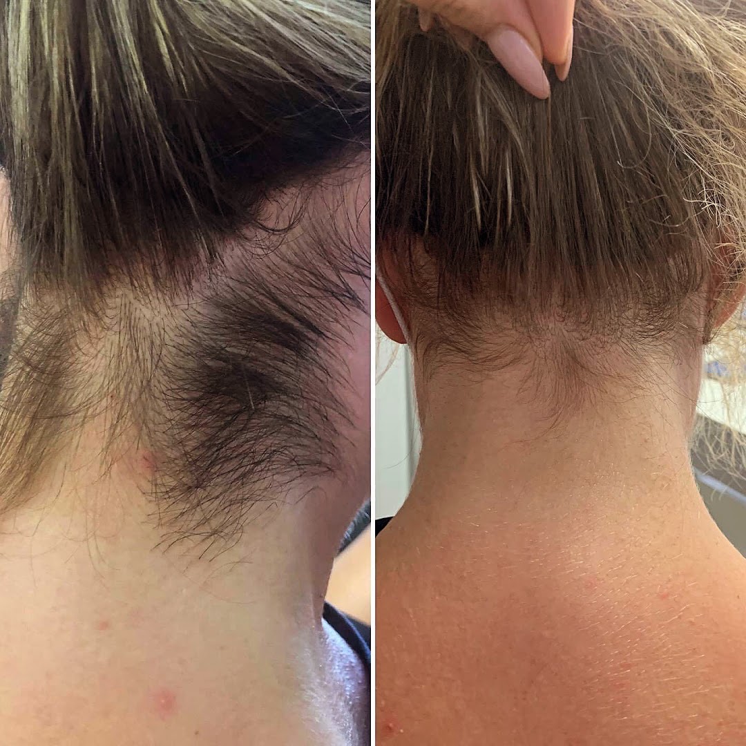 Foto van Haar Laser Team in Maldegem — Schoonheidssalon (foto 2)