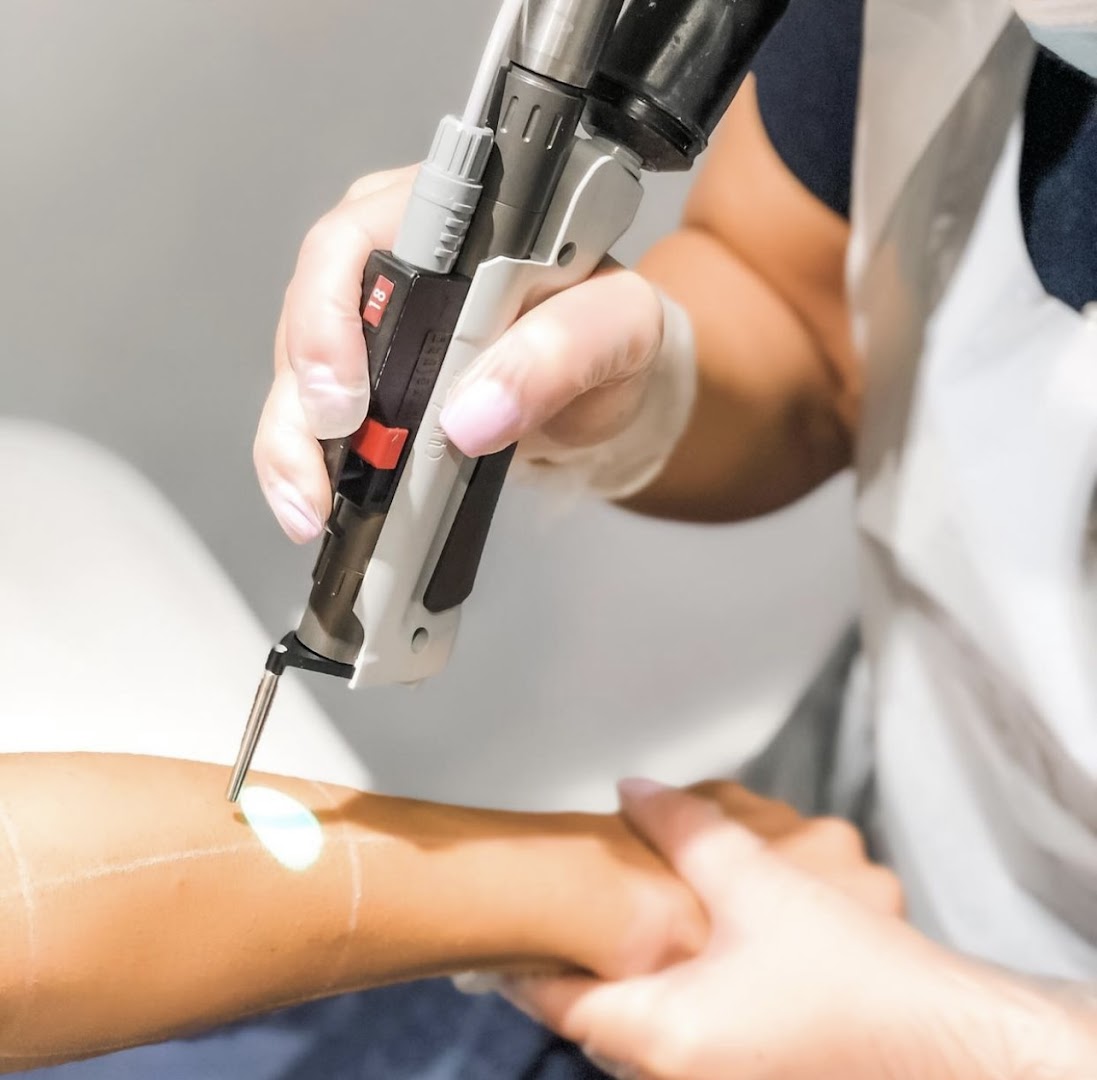 Foto van Hq laserclinic in Zwijndrecht — Ontharing met laser (foto 3)