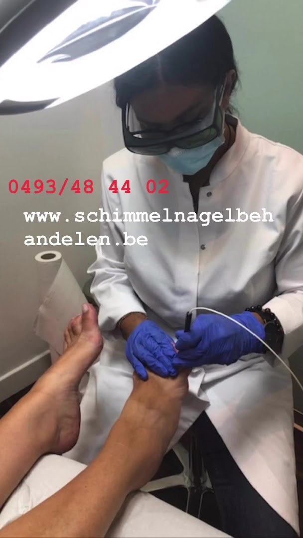 Foto van Schimmelnagels Laseren footlaser PinPointe België - in Knokke-Heist — Nagelstudio (foto 2)