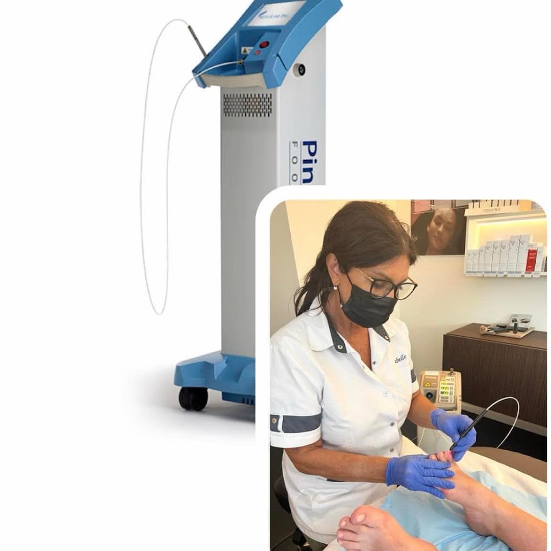 Foto van Schimmelnagels Laseren footlaser PinPointe België - in Knokke-Heist — Nagelstudio (foto 3)