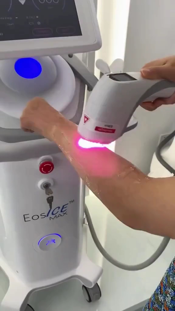 Foto van SkinNails Studio in Antwerpen — Ontharing met laser (foto 2)