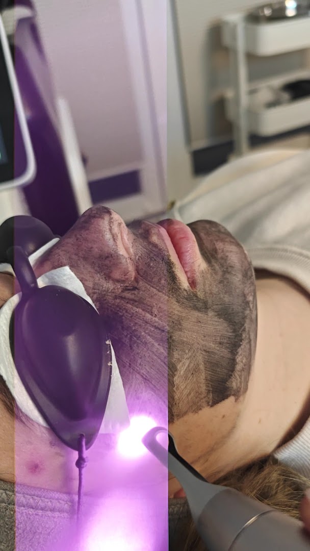 Foto van Soft skin - Laser Studio in Kortenberg — Schoonheidsspecialist (foto 3)