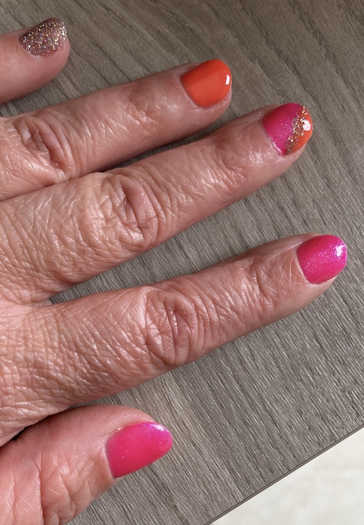 Foto van SUBLIME-beauty.be in Ieper — Ontharing met laser (foto 1)